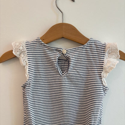 Striped Lace-Trim Bodysuit (12-18M)